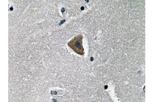 Immunohistochemistry analyzes of Rock-1 antibody in paraffin-embedded human brain tissue. (ROCK1 抗体)
