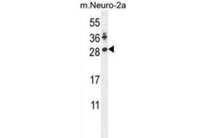 Western Blotting (WB) image for anti-Lin-28 Homolog A (C. Elegans) (LIN28A) antibody (ABIN2996080) (LIN28A 抗体)
