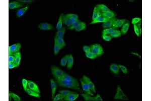 Immunofluorescence staining of HepG2 cells with ABIN7163597 at 1:100, counter-stained with DAPI. (PAFAH2 抗体  (AA 1-206))