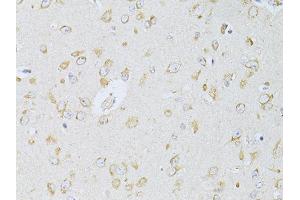 Immunohistochemistry of paraffin-embedded rat brain using NTS antibody (ABIN5998396) at dilution of 1/100 (40x lens). (Neurotensin 抗体)