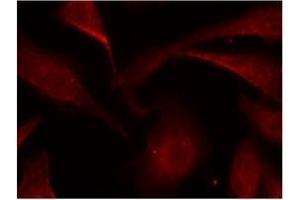 Image no. 3 for anti-Nuclear Factor-kB p65 (NFkBP65) (pSer529) antibody (ABIN196955) (NF-kB p65 抗体  (pSer529))