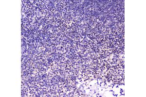 IHC analysis of CBFb using anti-CBFb antibody .