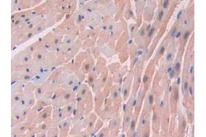 DAB staining on IHC-P;;Samples: Mouse Heart Tissue (FABP3 抗体  (AA 1-133))
