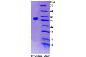 SDS-PAGE (SDS) image for Dyskeratosis Congenita 1, Dyskerin (DKC1) (AA 298-509) protein (His tag) (ABIN4989256)