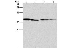 Western Blot analysis of Human placenta tissue and NIH/3T3 cell, Raji and hepG2 cell using BCAT2 Polyclonal Antibody at dilution of 1:312. (BCAT2 抗体)