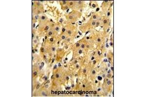 Immunohistochemistry (Paraffin-embedded Sections) (IHC (p)) image for anti-4-Hydroxyphenylpyruvate Dioxygenase (HPD) (AA 92-121), (N-Term) antibody (ABIN652531)