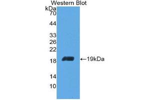Western Blotting (WB) image for anti-Aconitase 1 (ACO1) (AA 669-834) antibody (ABIN1857865)