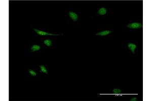 Immunofluorescence of monoclonal antibody to EIF1AY on HeLa cell. (EIF1AY 抗体  (AA 22-95))