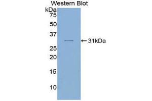 Western Blotting (WB) image for anti-SMAD, Mothers Against DPP Homolog 6 (SMAD6) (AA 116-364) antibody (ABIN1860594) (SMAD6 抗体  (AA 116-364))
