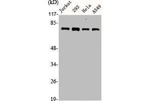Western Blot analysis of Jurkat 293 HELA A549 cells using Actinin-α1/2/3/4 Polyclonal Antibody (ACTN1/ACTN2/ACTN3/ACTN4 (N-Term) 抗体)