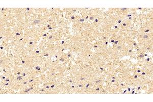 Immunohistochemistry (IHC) image for anti-Tubulin, beta (TUBB) (AA 170-419) antibody (ABIN7428962)