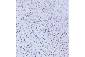 IHC analysis of TPR using anti-TPR antibody (ABIN5693275). (TPR 抗体)