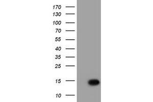 Western Blotting (WB) image for anti-Chromosome 17 Open Reading Frame 37 (C17orf37) antibody (ABIN1501781) (C17orf37 抗体)