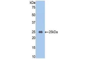 Western blot analysis of recombinant Mouse CPB2/TAFI. (CPB2 抗体  (AA 187-327))