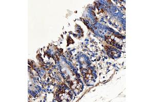 IHC analysis of SH2D4A using anti-SH2D4A antibody (ABIN7601695). (SH2D4A 抗体  (AA 42-454))