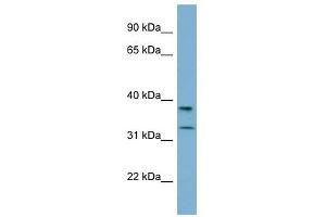 RALGPS2 antibody used at 1 ug/ml to detect target protein. (RALGPS2 抗体  (N-Term))