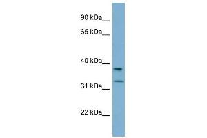 Western Blotting (WB) image for anti-Ral GEF with PH Domain and SH3 Binding Motif 2 (RALGPS2) (N-Term) antibody (ABIN630757)