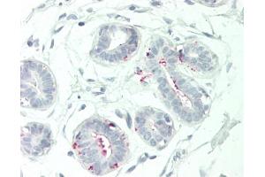 Human Breast: Formalin-Fixed, Paraffin-Embedded (FFPE)