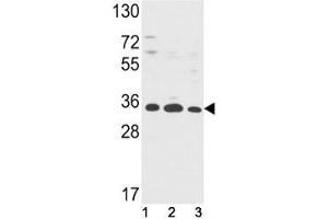 Western blot analysis of Annexin V antibody and (1) HepG2, (2) A2058, (3) T47D lysate. (Annexin V 抗体  (AA 1-30))