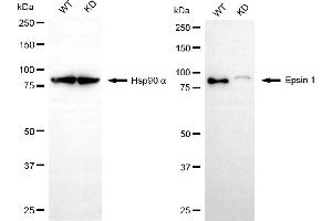 Western blotting analysis using epsin 1 antibody (ABIN7798486). (Recombinant Epsin 1 抗体)