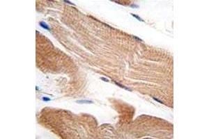IHC analysis of FFPE human skeletal muscle tissue stained with ILK1 antibody (ILK 抗体  (AA 151-180))