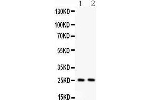 Anti- TNF alpha Picoband antibody, Western blotting All lanes: Anti TNF alpha  at 0. (TNF alpha 抗体  (AA 80-227))