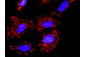 Proximity Ligation Analysis of protein-protein interactions between CUL1 and FBXW11. (Cullin 1 抗体  (AA 1-776))