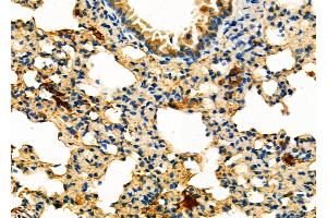 ABIN6263519 and ABIN6276723 at 1/100 staining Mouse lung tissue by IHC-P. (NAT1 抗体  (Internal Region))
