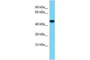 Host: Rabbit Target Name: CCDC121 Sample Type: Fetal Brain lysates Antibody Dilution: 1. (CCDC121 抗体  (Middle Region))
