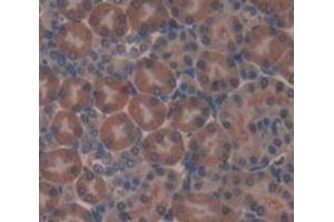 Used in DAB staining on fromalin fixed paraffin- embedded Kidney tissue (AASS 抗体  (AA 477-926))