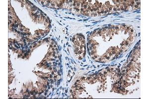 Immunohistochemical staining of paraffin-embedded Human liver tissue using anti-C17orf28 mouse monoclonal antibody.