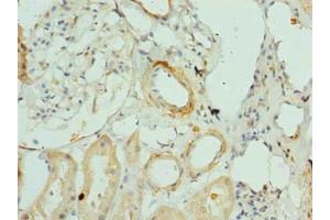 Immunohistochemistry of paraffin-embedded human kidney tissue using ABIN7144163 at dilution of 1:100 (ANKMY1 抗体  (AA 1-220))