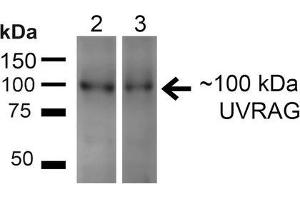 Western blot analysis of Human HeLa and 293T cell lysates showing detection of ~100kDa UVRAG protein using Rabbit Anti-UVRAG Polyclonal Antibody . (UVRAG 抗体  (FITC))