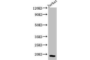 Western Blot Positive WB detected in: Jurkat whole cell lysate All lanes: CD247 antibody at 3 μg/mL Secondary Goat polyclonal to rabbit IgG at 1/50000 dilution Predicted band size: 19 kDa Observed band size: 19 kDa (CD247 抗体  (AA 88-153))