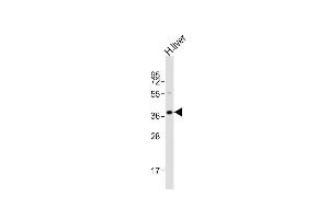 Western Blotting (WB) image for anti-LIM Homeobox Transcription Factor 1, alpha (LMX1A) (AA 303-337), (C-Term) antibody (ABIN6242392)
