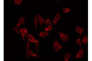 Immunofluorescence (fixed cells) (IF/ICC) image for anti-Actin, alpha 2, Smooth Muscle, Aorta (ACTA2) (N-Term) antibody (ABIN6254917)