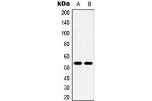 Western blot analysis of 5-HT2B expression in HeLa (A), HT29 (B) whole cell lysates. (Serotonin Receptor 2B 抗体  (N-Term))