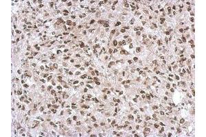 Image no. 1 for anti-Smad Nuclear Interacting Protein 1 (SNIP1) (AA 41-363) antibody (ABIN1501920) (SNIP1 抗体  (AA 41-363))