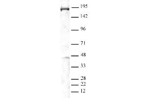 PBRM1 antibody (pAb) tested by Western blot. (Polybromo 1 抗体  (N-Term))
