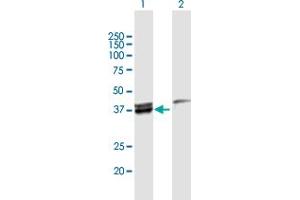 Western Blot analysis of MECR expression in transfected 293T cell line by MECR MaxPab polyclonal antibody.