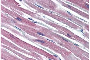 Human Heart (formalin-fixed, paraffin-embedded) stained with S100A1 antibody ABIN790334 at 10 ug/ml followed by biotinylated goat anti-rabbit IgG secondary antibody ABIN481713, alkaline phosphatase-streptavidin and chromogen.