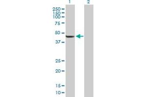Western Blot analysis of TBL2 expression in transfected 293T cell line by TBL2 MaxPab polyclonal antibody. (TBL2 抗体  (AA 1-447))