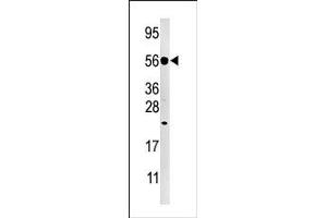 Image no. 1 for anti-Dual Specificity Phosphatase 8 (DUSP8) (C-Term) antibody (ABIN360785) (DUSP8 抗体  (C-Term))
