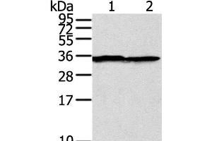 Western Blot analysis of A375 cell using STX3 Polyclonal Antibody at dilution of 1:400 (STX3 抗体)