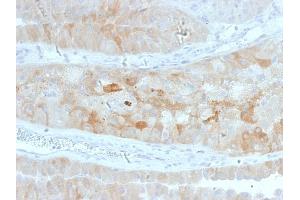 Formalin-fixed, paraffin-embedded human Kidney stained with ROR2 Mouse Monoclonal Antibody (ROR2/1912). (ROR2 抗体)