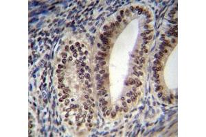 Progesterone Receptor antibody immunohistochemistry analysis in formalin fixed and paraffin embedded human uterus tissue.