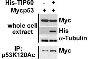 Western Blotting (WB) image for anti-Tumor Protein P53 (TP53) (acLys315) antibody (ABIN3201007)