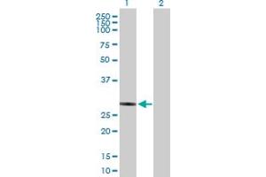 Western Blot analysis of NUBPL expression in transfected 293T cell line by NUBPL MaxPab polyclonal antibody. (NUBPL 抗体  (AA 1-289))