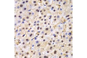 Immunohistochemistry (IHC) image for anti-TAR DNA Binding Protein (TARDBP) (AA 1-260) antibody (ABIN3021656) (TARDBP 抗体  (AA 1-260))