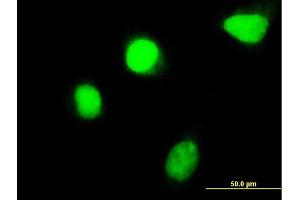 Immunofluorescence of monoclonal antibody to HOXC4 on HeLa cell. (HOXC4 抗体  (AA 160-264))